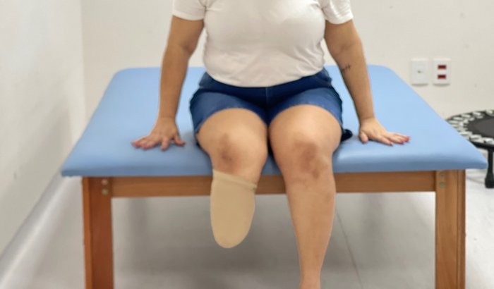 Compra de prótese ortopédica 