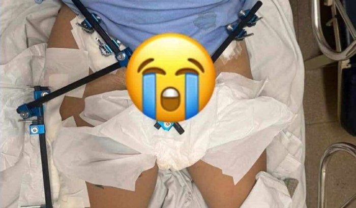 Eu sou um milagre de Deus ❤️🩹😭