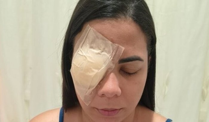 Cirurgia  da catarata severa 