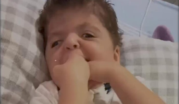 Ajude a salvar a vida do pequeno isack🙌🏽