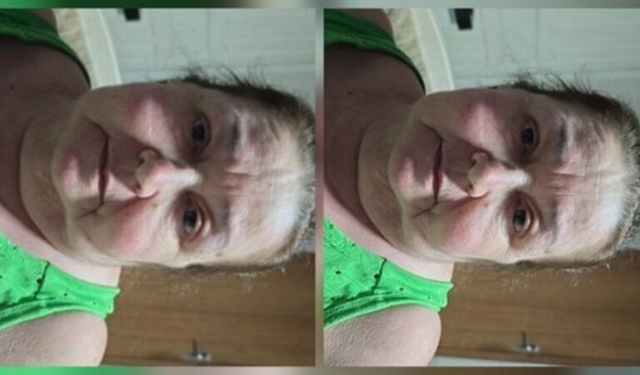 Fazer uma angioplastia de emergência