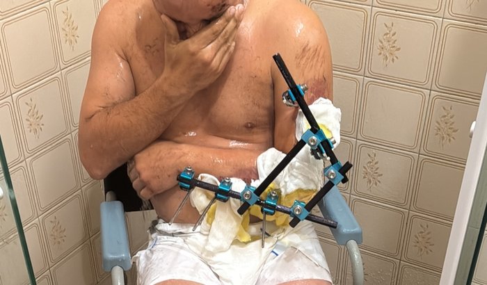 Um novo começo: reconstruindo meu trabalho com sua ajuda