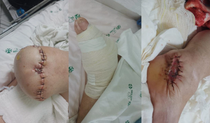 Uma jornada de esperança: ajude a Maria Aparecida