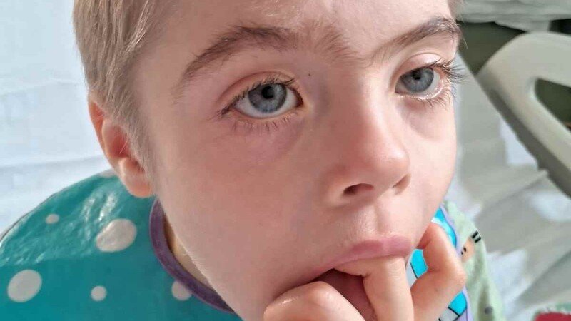 Tratamento de  Saúde do Arthur 