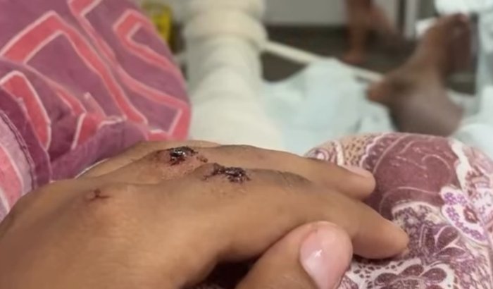 Ajuda pra recuperação da Havila