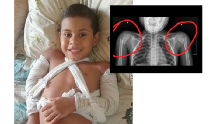 Ajude no Tratamento de Luis Felipe Lima