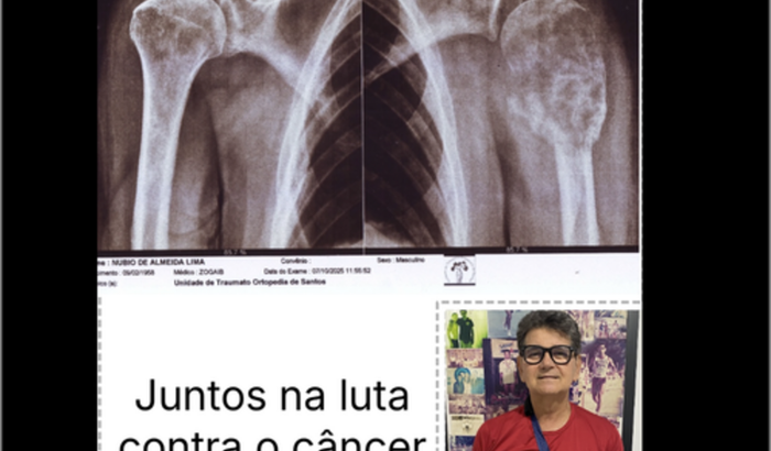 Colabore para cirurgia urgente do Nubio.