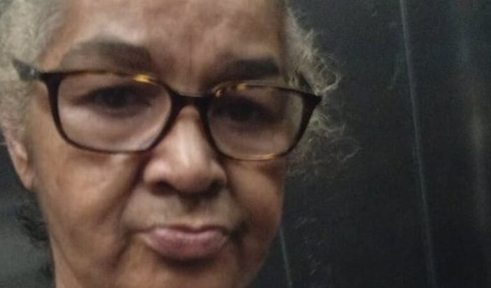 Ajuda para arrumar os dentes 