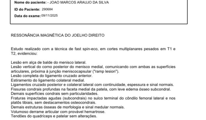 Cirurgia de LCA e menisco