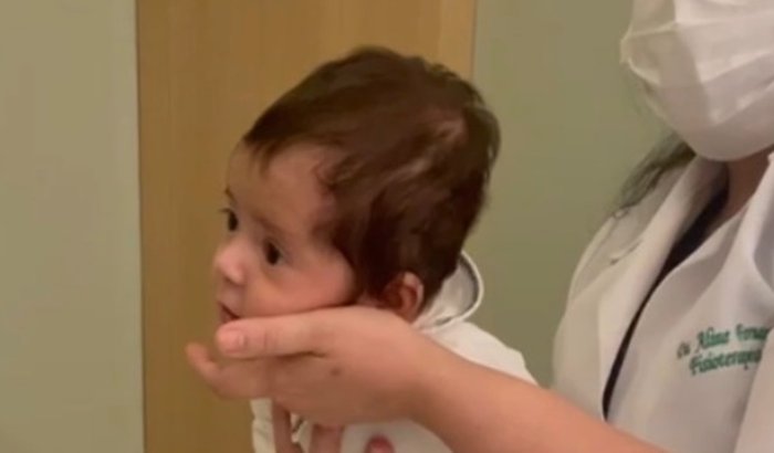 Ajude a Ben a colocar a órtese craniana (capacete)