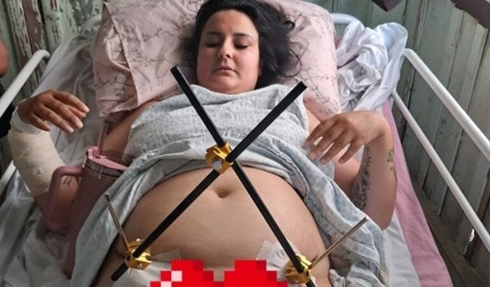 Ajude a Ary após o acidente gravíssimo