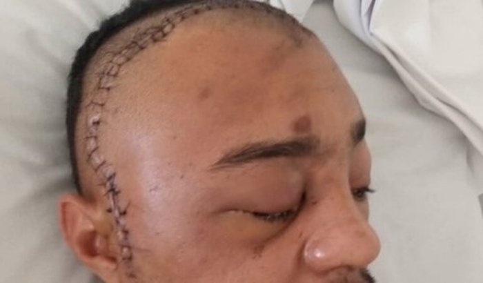 Tratamento oncológico