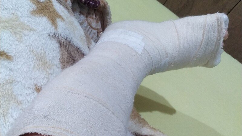 Ajuda para Misael que teve acidente de trabalho e está impossibilitado de trabalhar.