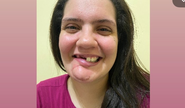 Ajude a Maria voltar a Sorrir