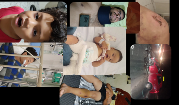 Vaquinha para tratamento Família após acidente