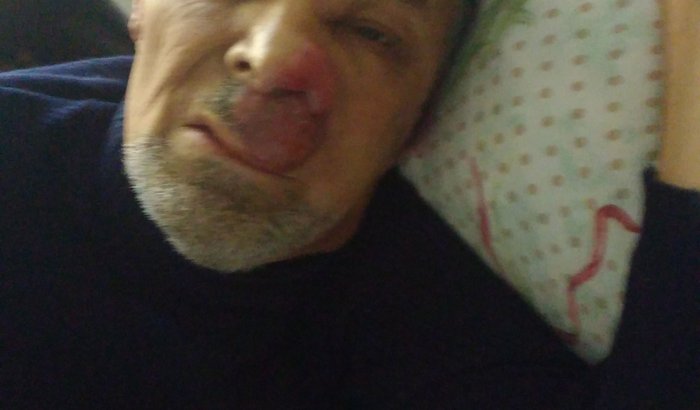 Ajudem meu pai nessa batalha contra o câncer