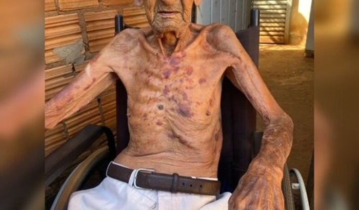 Juntos pelo seu João