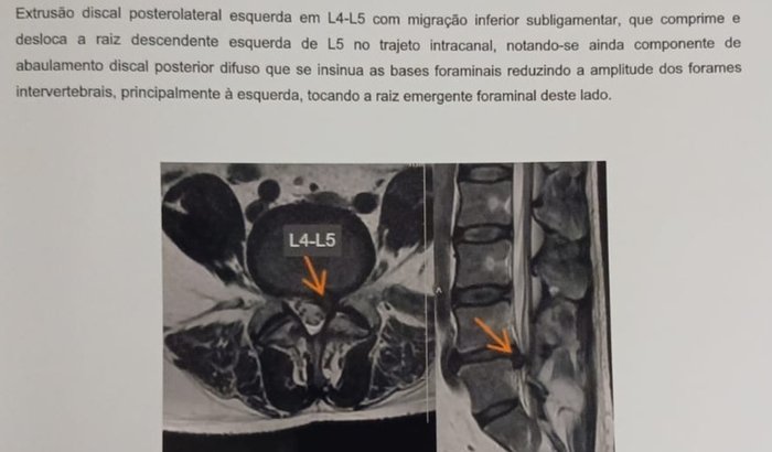 Ajuda pra cirurgia de coluna João Carvalho