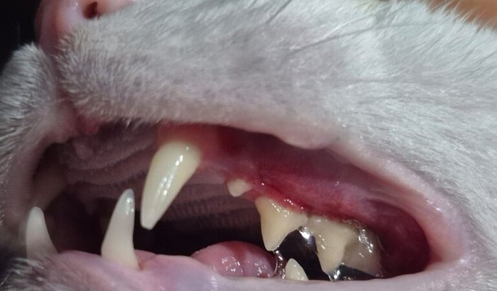 Ajude a Ruth a viver sem dor – extração total dos dentes