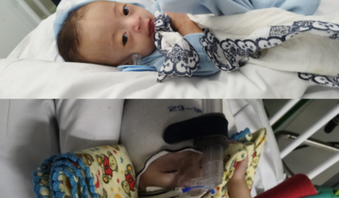 Fórmula do pequeno LeVi