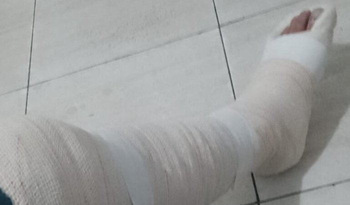 Ajuda para pagar as contas após o acidente de moto (1 mês sem trabalhar)