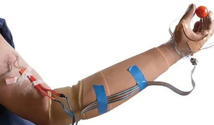 Próteses Biônicas de Baixo Custo