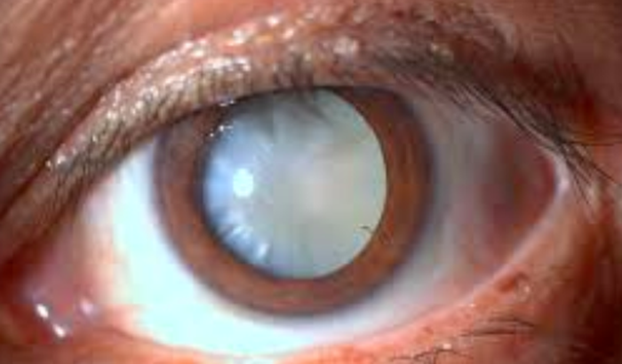 Visão Solidária para a Josefa