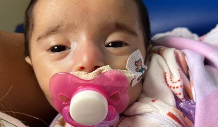 AJUDE A PEQUENA ALICIA