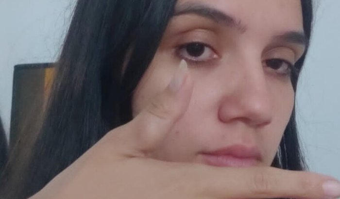 Cirurgia Tumor de células gigantes preciso de ajuda