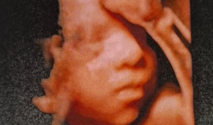 Para ajudar o Frederico 🤍