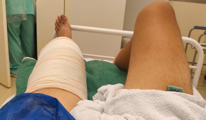 Ajuda recuperação acidente, lesão grave