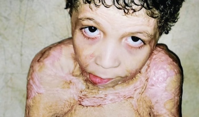 Todos pelo Wellynton