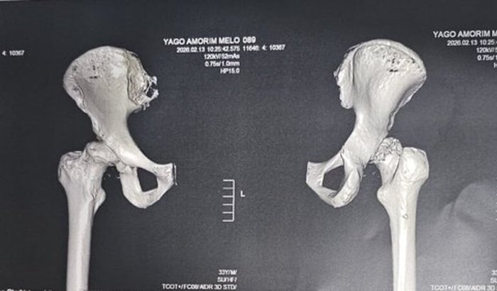 Cirurgia de emergência