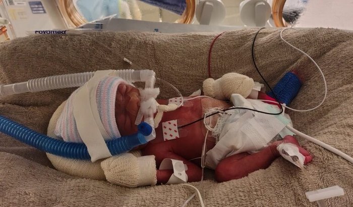 Juntos pelo Coração da Ana Luísa