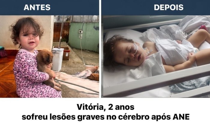 Urgente: Vitória, 2 anos, sofreu lesões graves no cérebro