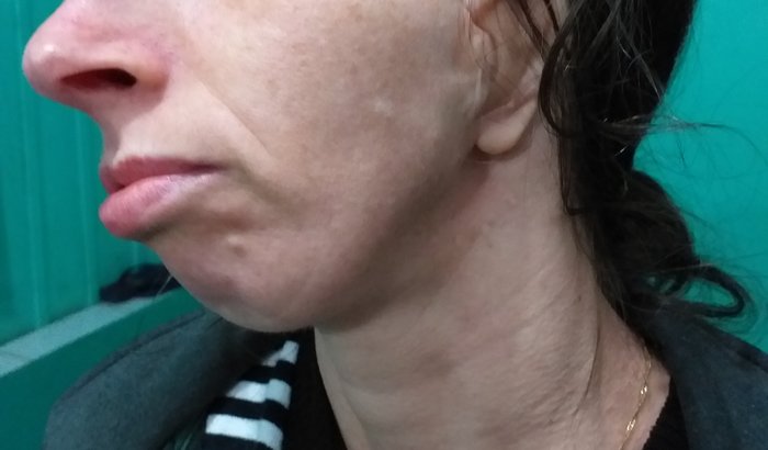 Ajudem para a cirurgia da minha esposa