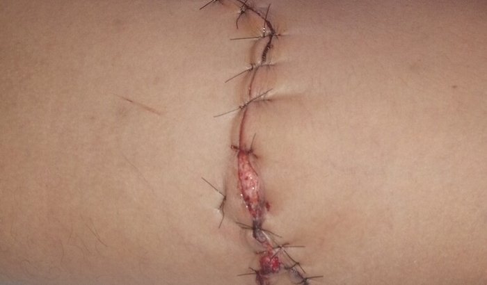 Ajuda para meu esposo acidentou e não tem como trabalhar