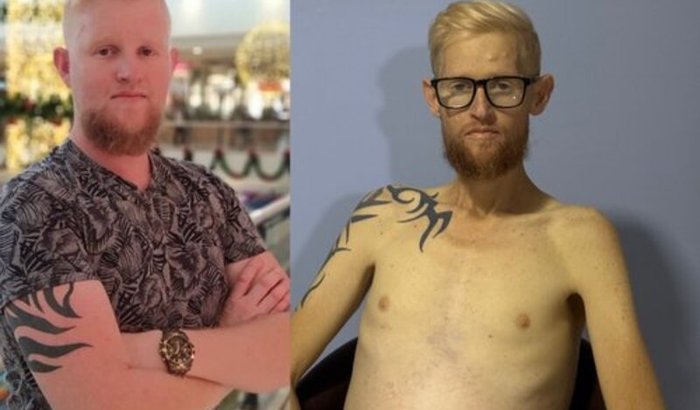 Tratamento de câncer do Allefe (urgente)