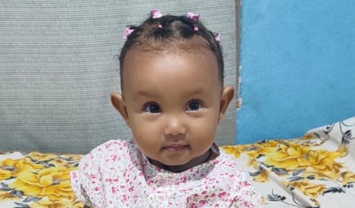 Ajuda para cirurgia da Aylla