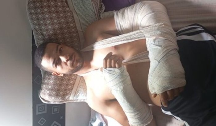 Ajuda para Gabriel e Naiara: Recuperação pós-acidente de moto