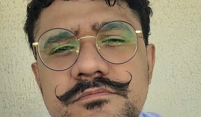 👉 Sua ajuda pode me colocar de pé novamente (prótese urgente)