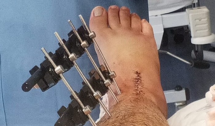 Recuperação do Pato ❤️🩹