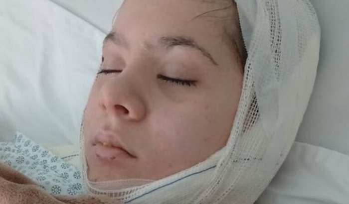 Tratamento da Maria Eduarda