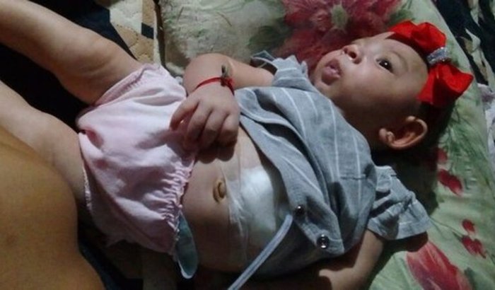 Ajude Maria Aurora de 8 meses de vida!