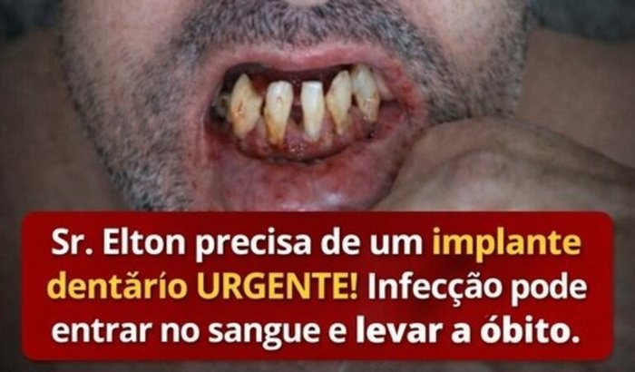 Ajuda Urgente: Sr. Elton
Fazer a cirurgia