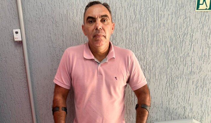 PROTÉSE PARA O RICARDO AJUDE ESSA CAUSA DE SUPERAÇÃO PÓS CÂNCER