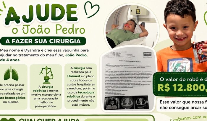 Cisto broncogênico João Pedro