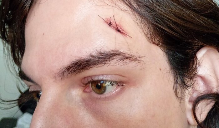 Ajuda para se recuperar de um assalto/tentativa de homicídio