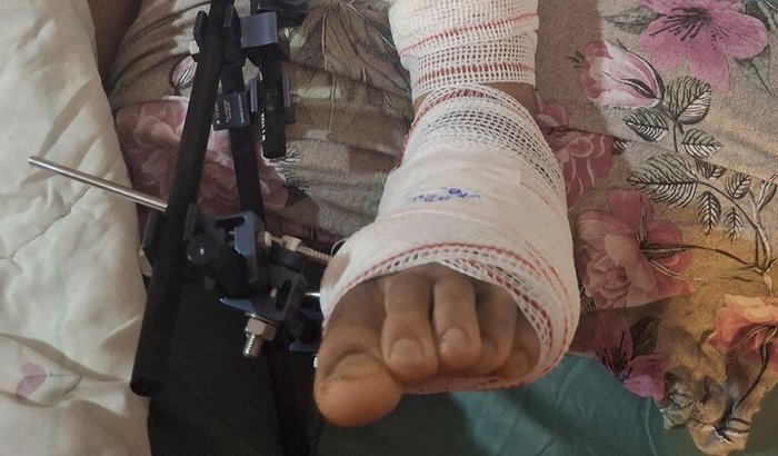 Ajuda para recuperação do Rafinha 🙏❤️