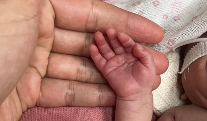 Todos pela vida da bebê Olívia